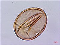 齒果酸模藏品圖，第3張