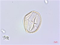 雙子野百合藏品圖，第2張