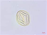 雙子野百合藏品圖，第3張