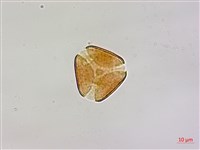 椆樹桑寄生, 大葉榿寄生藏品圖，第2張