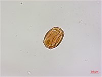 椆樹桑寄生, 大葉榿寄生藏品圖，第3張