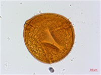 鄧氏胡頹子藏品圖，第3張