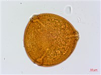 鄧氏胡頹子藏品圖，第4張