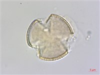 小葉瑞木藏品圖，第2張