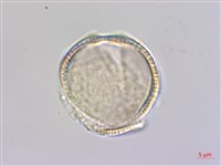 小葉瑞木藏品圖，第3張