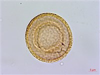 齒果酸模藏品圖，第3張