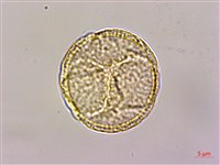 鉤柱毛茛藏品圖，第3張