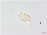 毒芹藏品圖，第2張