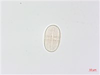 毒芹藏品圖，第3張