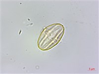 裂葉秋海棠藏品圖，第2張