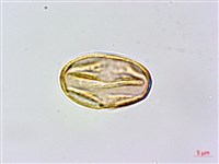 虎婆刺藏品圖，第3張