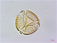 玉山金梅藏品圖，第3張