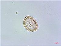 呂宋水錦樹藏品圖，第3張