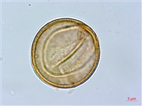 齒果酸模藏品圖，第3張