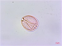 恆春鉤藤藏品圖，第2張