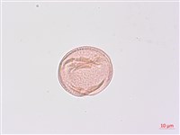 山香圓藏品圖，第3張