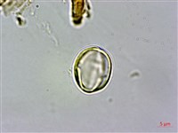 阿里山三斗石櫟、硬斗柯藏品圖，第3張