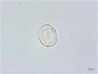 糙梗樓梯草藏品圖，第1張