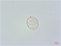 糙梗樓梯草藏品圖，第2張