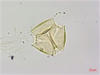 烏皮九芎、奮起湖野茉莉藏品圖，第1張