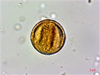 石苓舅藏品圖，第2張