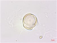 癭椒樹藏品圖，第1張