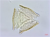 銀蓮花藏品圖，第2張