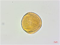 蘭嶼蘋婆藏品圖，第1張