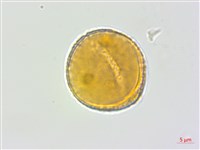 蘭嶼蘋婆藏品圖，第2張