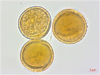 蘭嶼蘋婆藏品圖，第3張