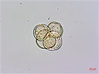 砲彈樹藏品圖，第2張