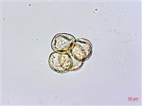 砲彈樹藏品圖，第3張