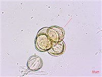 砲彈樹藏品圖，第4張