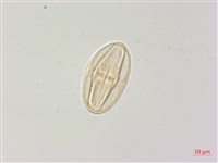 密花柴胡藏品圖，第1張