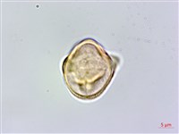 異葉囊瓣芹藏品圖，第3張