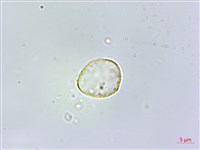 糙梗樓梯草藏品圖，第2張