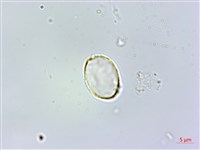 糙梗樓梯草藏品圖，第3張