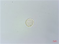 盤托樓梯草藏品圖，第1張