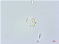 盤托樓梯草藏品圖，第2張