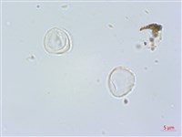 盤托樓梯草藏品圖，第3張