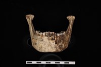 人骨藏品圖，第3張