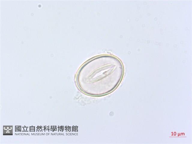 網脈雙蓋蕨藏品圖，第2張