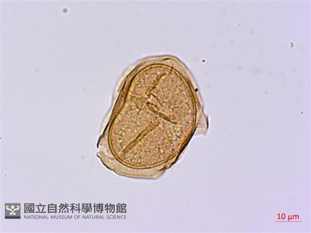 長苞雙蓋蕨、鱗柄雙蓋蕨藏品圖，第3張