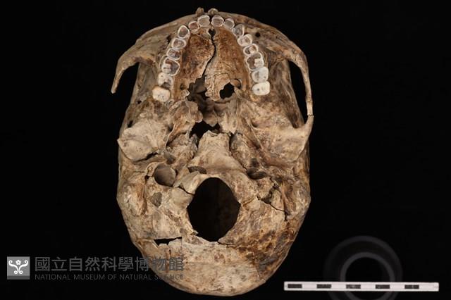 人骨藏品圖，第4張