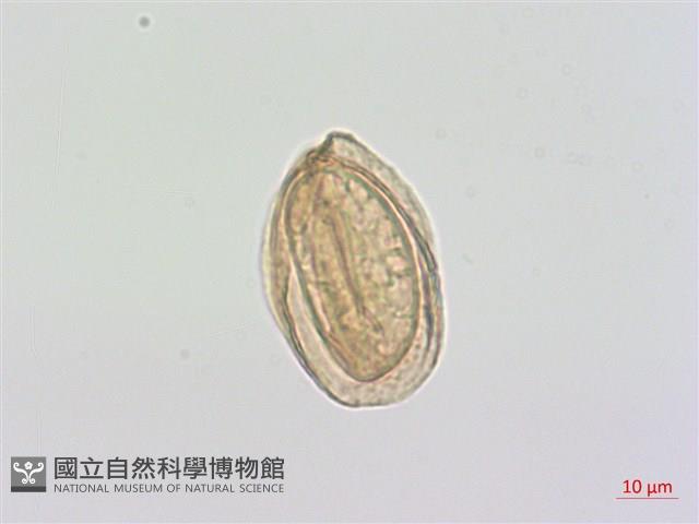細鱗雙蓋蕨、褐鱗雙蓋蕨藏品圖，第3張