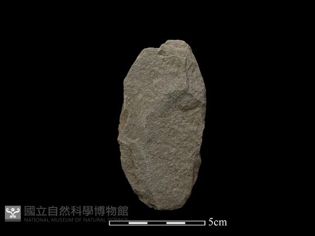 Accession Number:SLHCC-006 Collection Image, Figure 2, Total 2 Figures