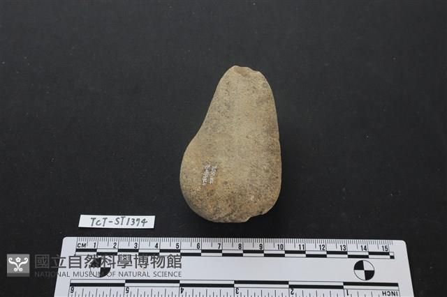 Accession Number:TCT-ST1374 Collection Image, Figure 1, Total 2 Figures