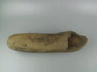 結核藏品圖，第3張