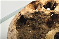 老年女性頭骨藏品圖，第8張