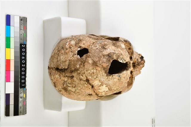 成年女性頭骨藏品圖，第8張
